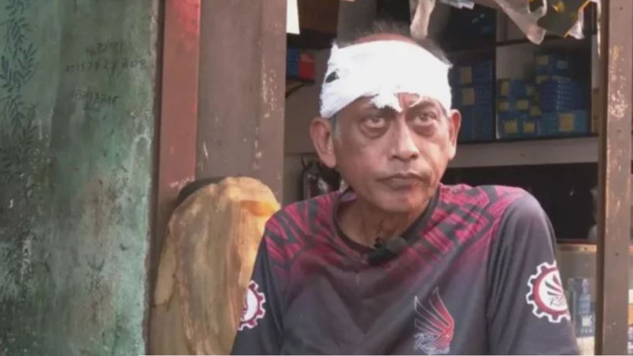 যশোরে অভিনেতা সমু চৌধুরীর মাথা ফাটালেন দুজন
